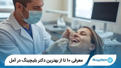 بهترین دکتر بلیچینگ در آمل