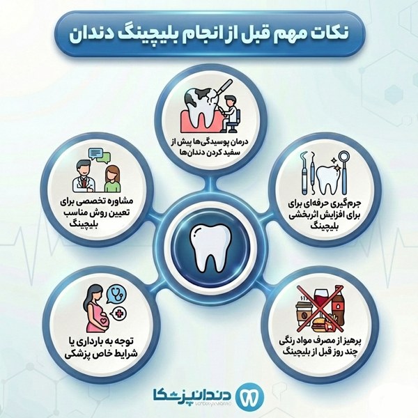  نکات مهم قبل از انجام بلیچینگ دندان