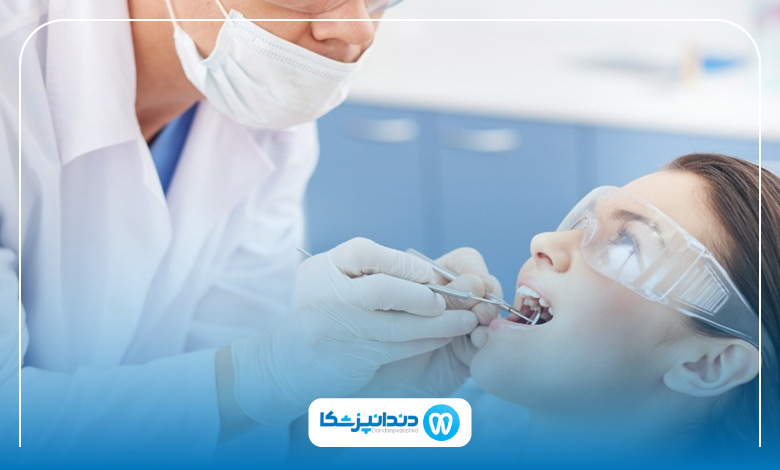 بهترین روش‌های بلیچینگ دندان