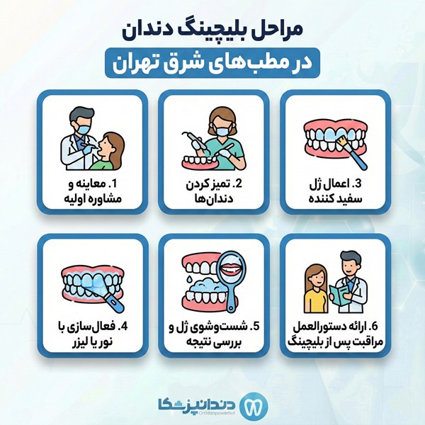 مراحل بلیچینگ دندان در مطب‌های شرق تهران