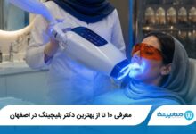 بهترین دکتر بلیچینگ در اصفهان