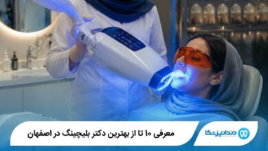 بهترین دکتر بلیچینگ در اصفهان