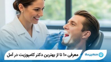 بهترین دکتر کامپوزیت در آمل