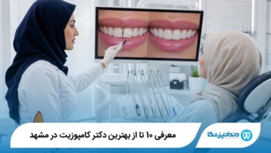 بهترین دکتر کامپوزیت در مشهد