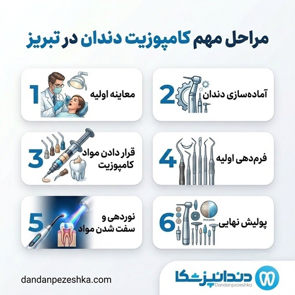 مراحل مهم کامپوزیت دندان در تبریز