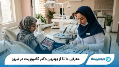 بهترین دکتر کامپوزیت در تبریز