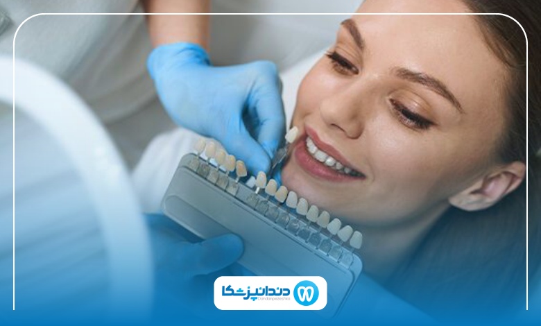 بهترین برندهای کامپوزیت دندان