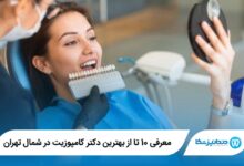 بهترین دکتر کامپوزیت در شمال تهران