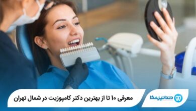 بهترین دکتر کامپوزیت در شمال تهران
