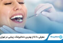 بهترین دندانپزشک زیبایی در تهران