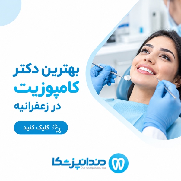بهترین دکتر کامپوزیت در زعفرانیه