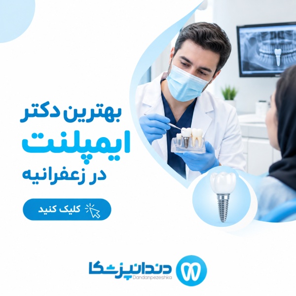  بهترین دکتر ایمپلنت در زعفرانیه