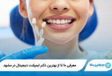 بهترین دکتر ایمپلنت دیجیتال در مشهد