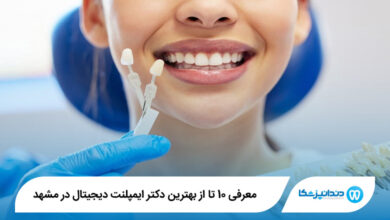 بهترین دکتر ایمپلنت دیجیتال در مشهد