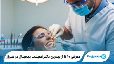 بهترین دکتر ایمپلنت دیجیتال در شیراز