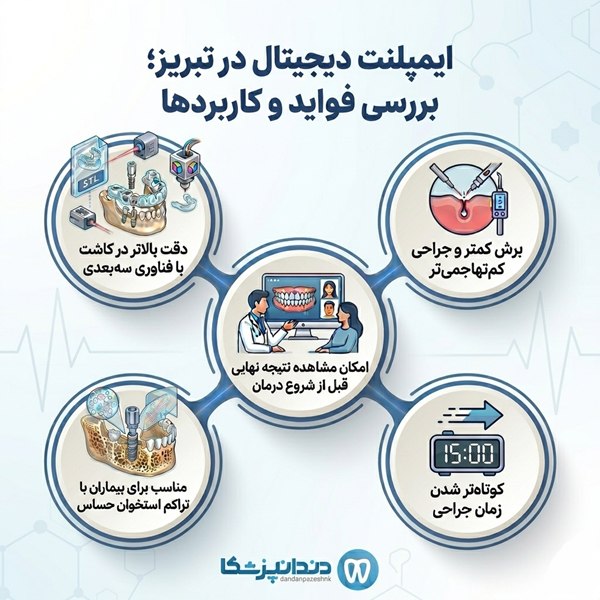 ایمپلنت دیجیتال در تبریز؛ بررسی فواید و کاربردها