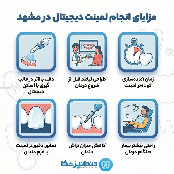 مزایای انجان لمینت دیجیتال در مشهد