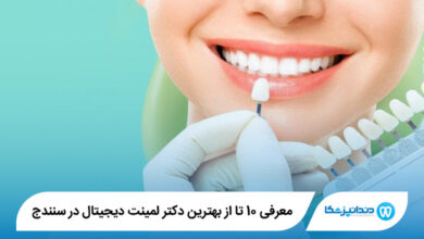 بهترین دکتر لمینت دیجیتال در سنندج