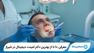 بهترین دکتر لمینت دیجیتال در شیراز