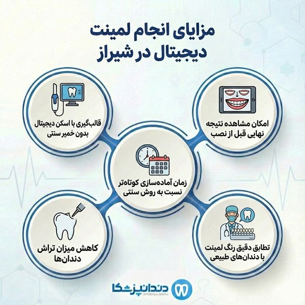 مزایای انجام لمینت دیجیتال در شیراز