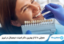 بهترین دکتر لمینت دیجیتال در تبریز