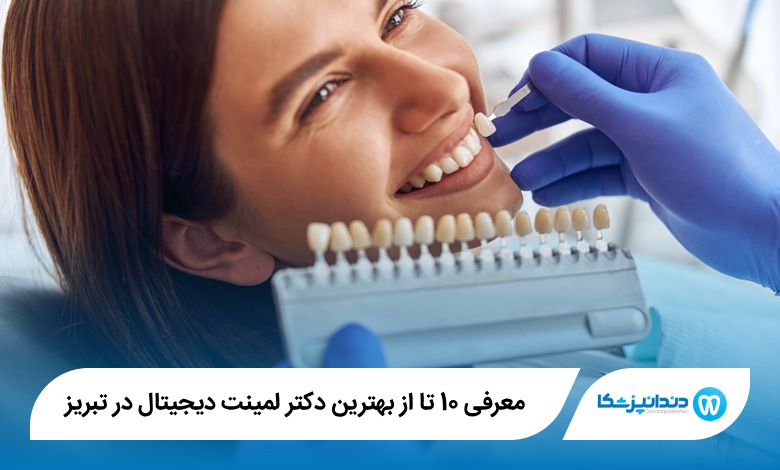 بهترین دکتر لمینت دیجیتال در تبریز