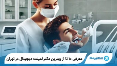بهترین دکتر لمینت دیجیتال در تهران