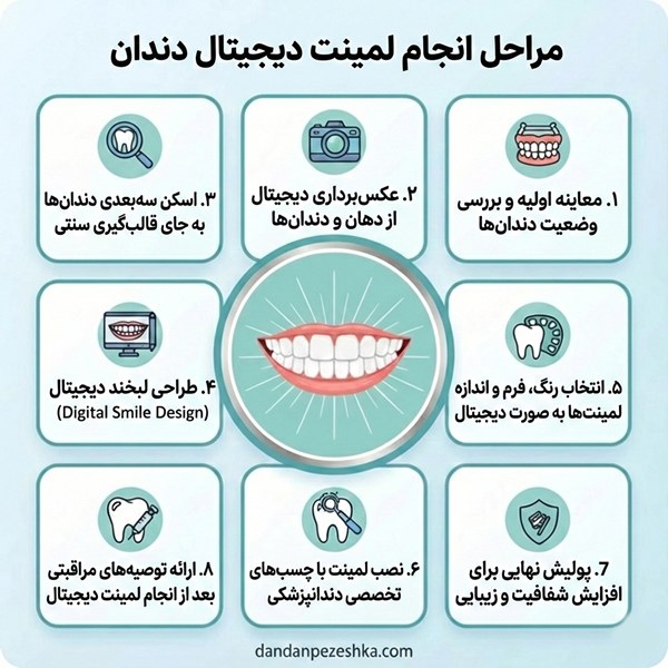 مراحل انجام لمینت دیجیتال دندان