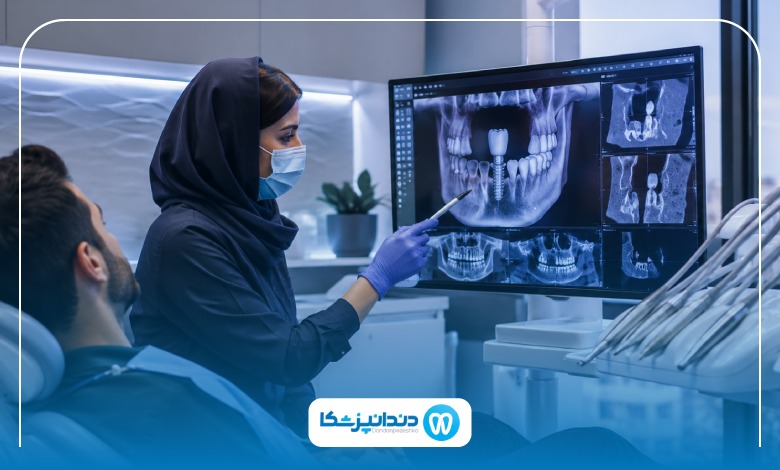 ایمپلنت فوری چگونه انجام میشود؟