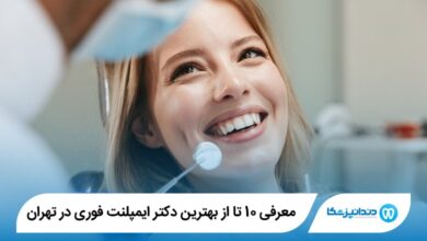 بهترین دکتر ایمپلنت فوری در تهران