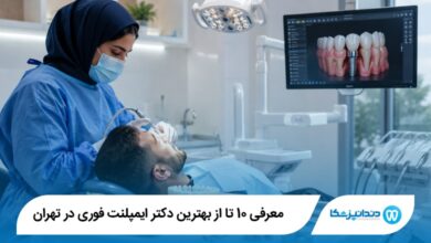 بهترین دکتر ایمپلنت فوری در تهران