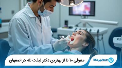 بهترین دکتر لیفت لثه در اصفهان