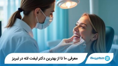 بهترین دکتر لیفت لثه در تبریز