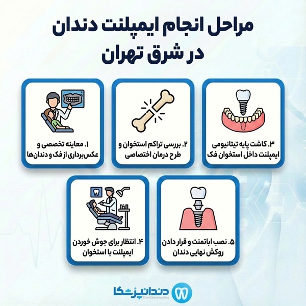 مراحل انجام ایمپلنت دندان در شرق تهران