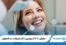 بهترین دکتر ایمپلنت در اصفهان