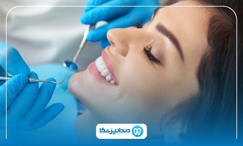 انواع برندهای ایمپلنت دندان