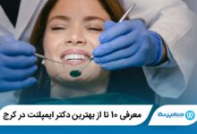 بهترین دکتر ایمپلنت دندان در کرج
