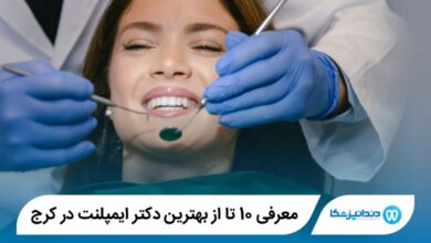 بهترین دکتر ایمپلنت دندان در کرج