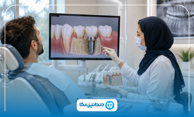 انواع پیوند استخوان در ایمپلنت دندان کدامند؟