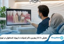 بهترین دکتر ایمپلنت با پیوند استخوان در تهران
