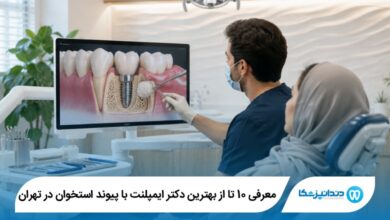 بهترین دکتر ایمپلنت با پیوند استخوان در تهران