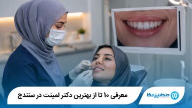 بهترین دکتر لمینت در سنندج