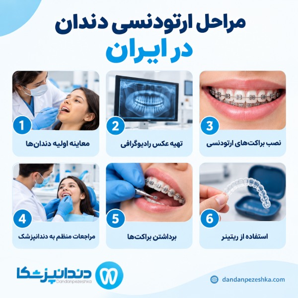 مراحل ارتودنسی دندان در ایران