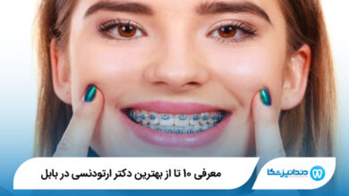 بهترین دکتر ارتودنسی در بابل