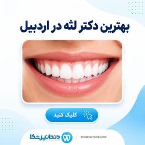 بهترین دکتر لثه در اردبیل