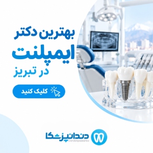 بهترین دکتر ایمپلنت ر تبریز