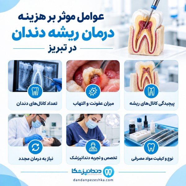 عوامل موثر بر هزینه درمان ریشه دندان در تبریز