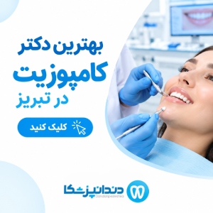 بهترین دکتر کامپوزیت در تبریز