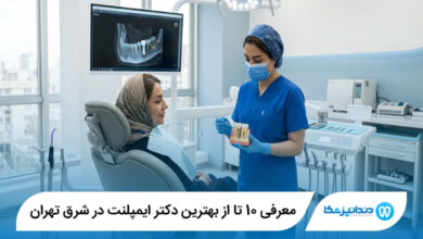 بهترین دکتر ایمپلنت در شرق تهران