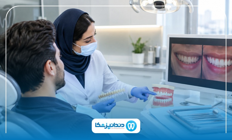 چه افرادی کاندید مناسب لمینت دیجیتال هستند؟